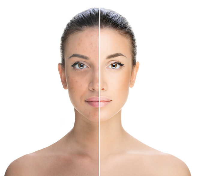 Pigmentation